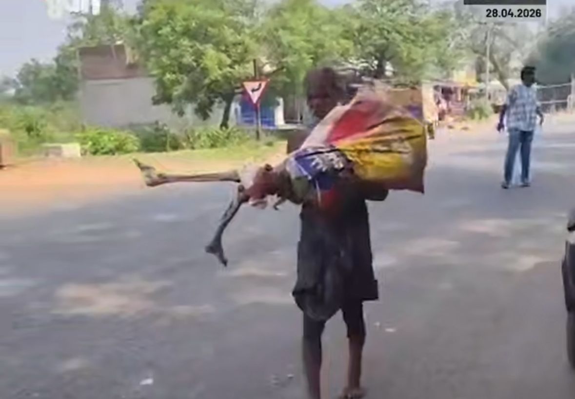 Hindistanda şok hadisə: pul üçün bacısının skeletini banka apardı