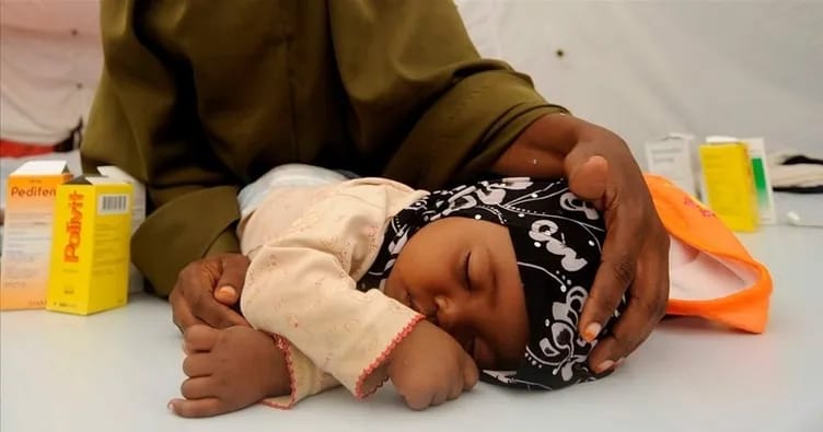 Nigeriyada qızılca epidemiyası: 15 uşaq həlak olub