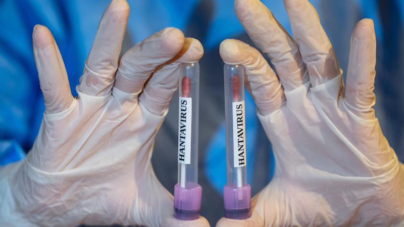 Hantavirus pandemiyaya çevriləcəkmi?