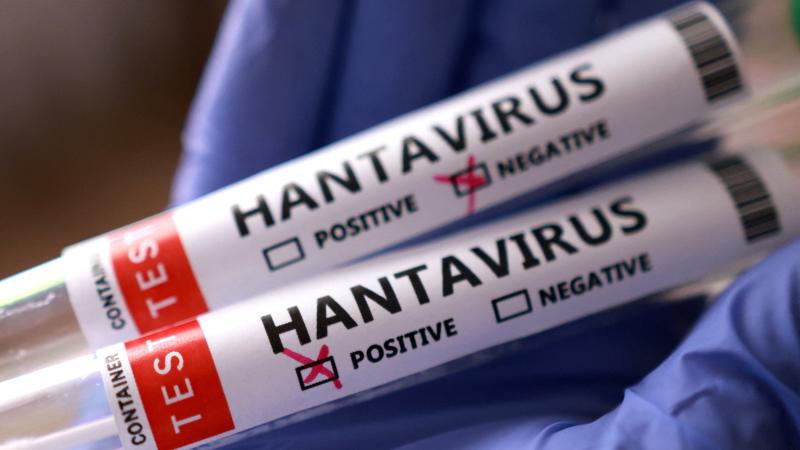 İsraildə bir nəfərdə hantavirus aşkarlanıb
