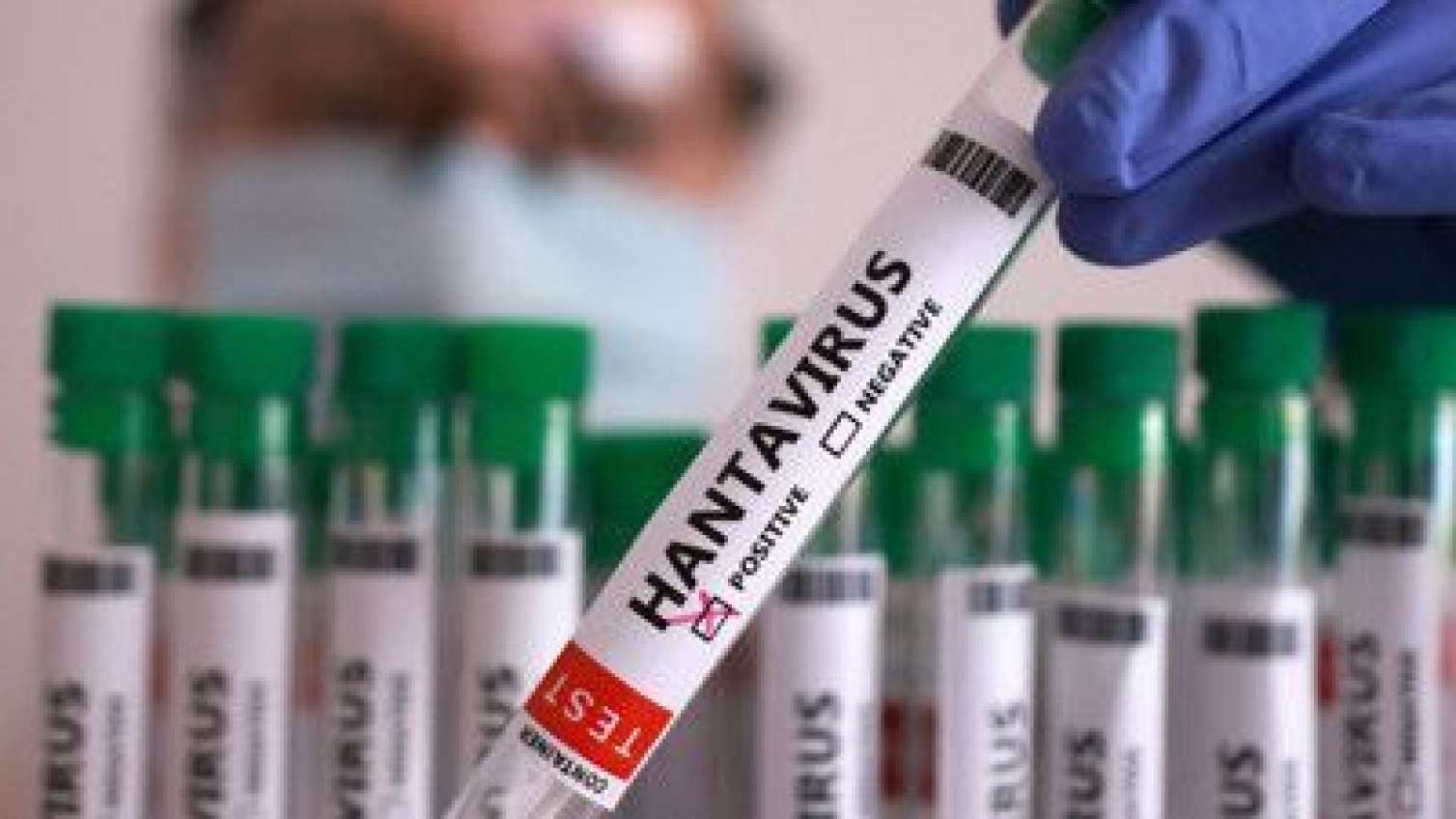 Hantavirus Azərbaycana gəlib? - RƏSMİ
