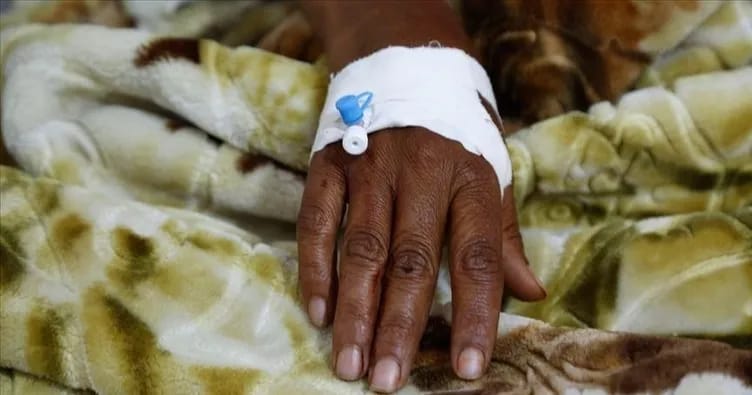 Nigeriyada Lassa qızdırmasından ölənlərin sayı 190 nəfərə çatıb