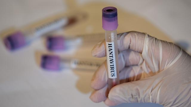ÜST-dən hantavirus xəbərdarlığı: Yeni yoluxmalar arta bilər