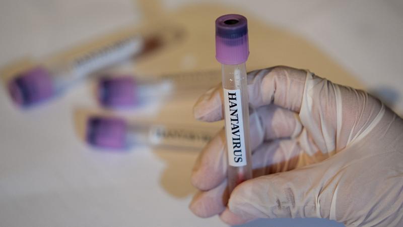ÜST: Ölkələr yeni hantavirus hallarına hazır olmalıdırlar