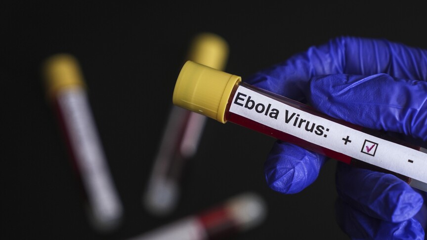 Konqo Demokratik Respublikasında 900-dən çox şübhəli Ebola hadisəsi qeydə alınıb