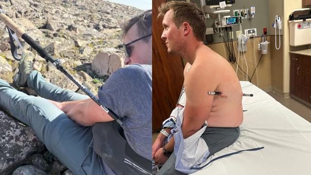 Bədəninə yürüş çubuğu batmış alpinist 16 kilometr yol qət edib