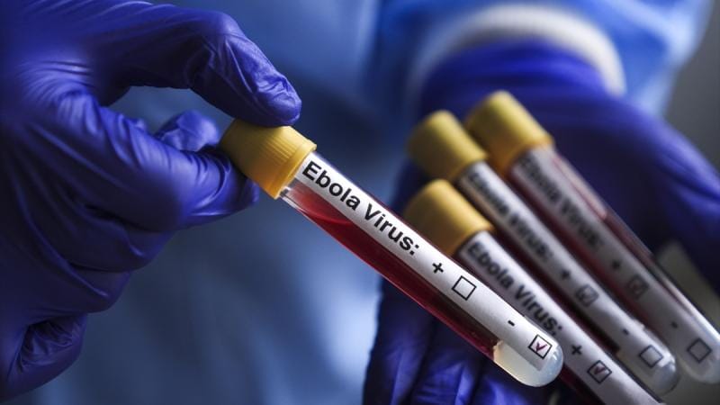ÜST Uqandada Ebola epidemiyasının başa çatdığını təsdiqləyib