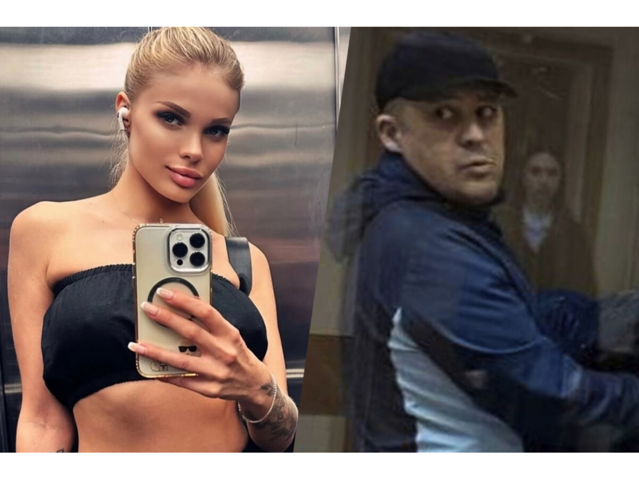 Rus model sevgilisi tərəfindən vəhşicəsinə döyüldü – Kəllə sümüyünün yarısını itirib - (Fotolar)