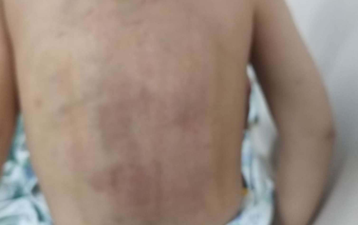 Döyülən 3 yaşlı uşağın anası valideynlikdən məhrum edilə bilər