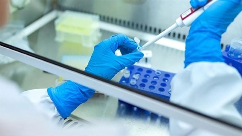 Rusiya Sibirdə taun laboratoriyası əməkdaşının ölümü ilə bağlı bəyanat yayıb