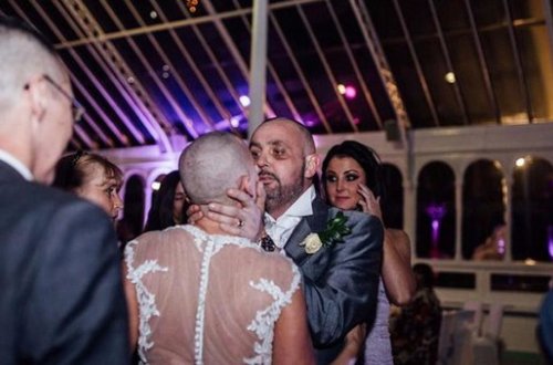 Gəlin toy günü saçını keçəl etdirdi, bəy ağladı