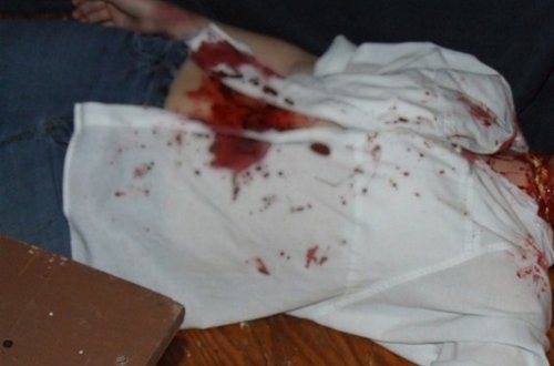 Azərbaycanlılara hücum edilib: 2 ölü, 1 yaralı