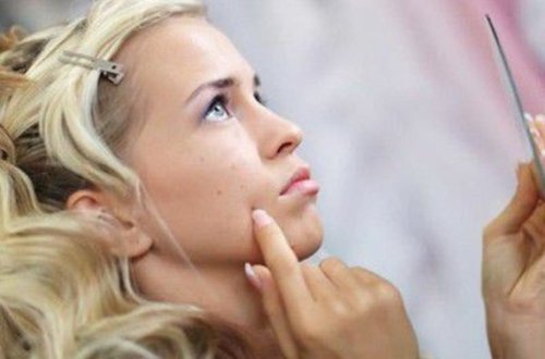 Sızanaqlardan xilas olmaq üçün