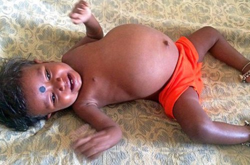 15 aylıq qızın qarnından çıxan şok yaratdı