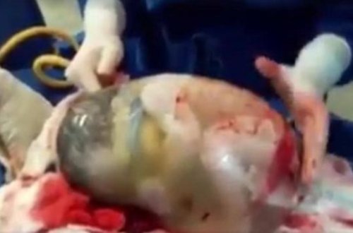 Doğuş zamanı inanılmaz hadisə