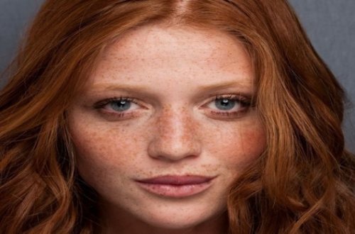 Üzdəki çilləri təbii üsulla necə yox edə bilərik?