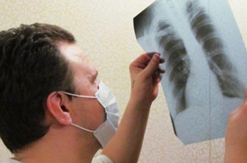 Siqaret haqda daha bir təhlükəli fakt