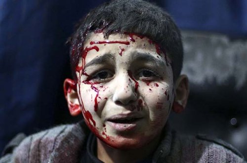 Suriyalı uşaqların fotosuna görə qalib oldu