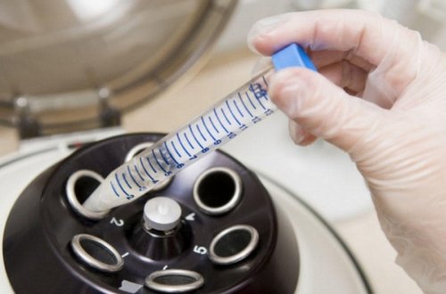 Alimlər süni sperma yetişdiriblər