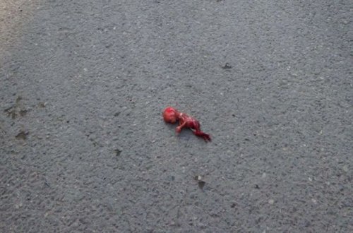 Bakda abort qalıqları yolun ortasına düşdü