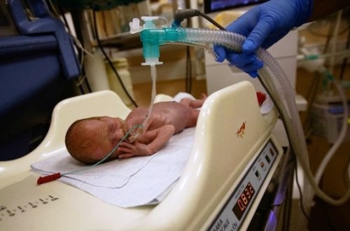 Ötən ay 18 uşaq ölüb