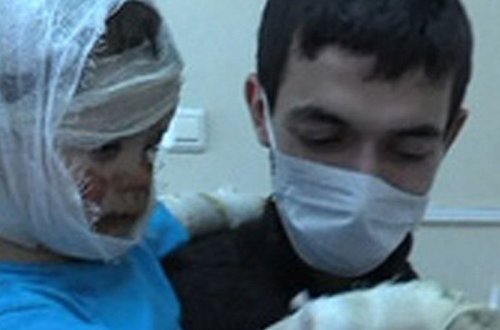 Yandırılan azərbaycanlı uşaqdan xəbər var