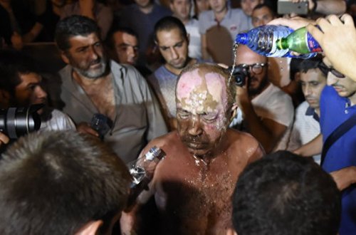 Sarkisyanın sarayı qarşısında özünü yandıran erməni etirazçı öldü