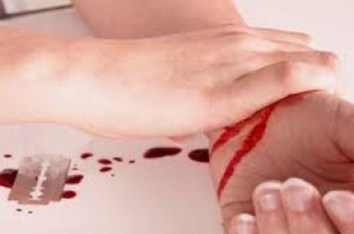 Xaçmazda qadın həkim damarlarını doğradı