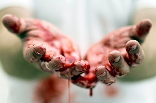 Ərini hər iki ayağından bıçaqladı