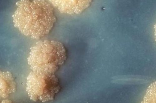 Vərəmdən qorunmağın yolları və