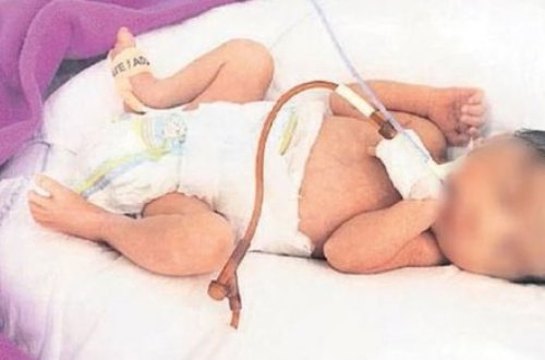 Həkimlər doğuş üçün tezdi dedilər, qız tualetdə ana oldu