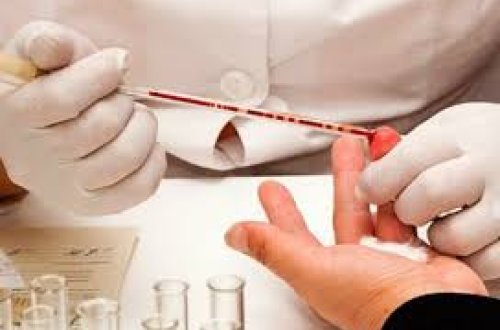 “Donuz qripi” şübhəsi ilə 50 nəfərdən qan nümunəsi götürüldü