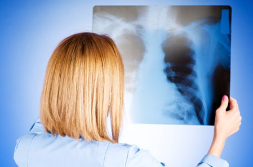 Ermənistan xəstəxanalarında 420 pnevmoniya xəstəsi var