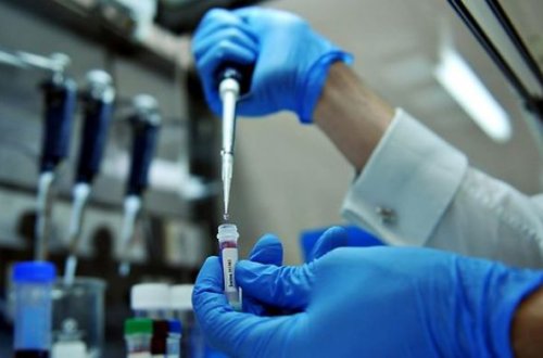 Türkiyədə 463 nəfər `donuz qripi`nə yoluxub