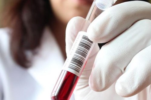 Ermənistanda “donuz qripi” epidemiyası