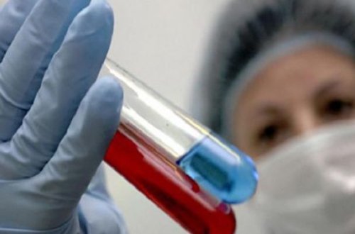 Dövlət qurumu “donuz qripi”nə görə gücləndirilmiş iş rejiminə keçdi