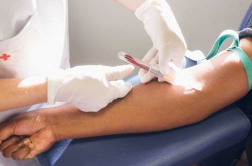 Ermənistanda “donuz qripi” epidemiyası