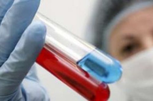 Azərbaycanda “donuz qripi” təhlükəsi