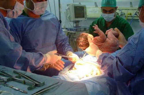 Ananın ikinci övladı da doğuşdan sonra öldü