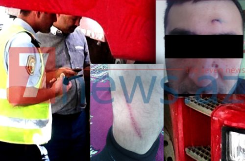 DYP əməkdaşları tərəfindən vəhşicəsinə döyülən “Şaqman” sürücüsünün