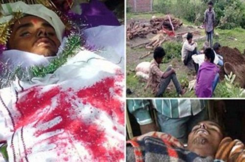 Dəfnində dirildi, həkimin savadsızlığından yenidən öldü