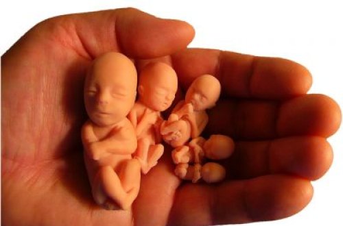 Azərbaycanda dəhşətli STATİSTİKA