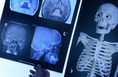 Müsəlmanları öldürmək üçün rentgen yaradan amerikalıya hökm oxundu