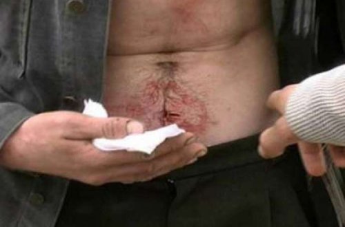 Azərbaycanda ağlasığmaz intihar