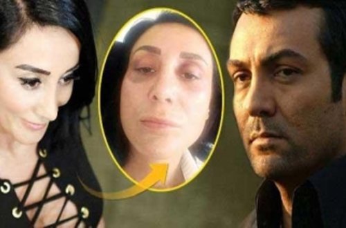 Sevgilisini 200 minə görə döyübmüş