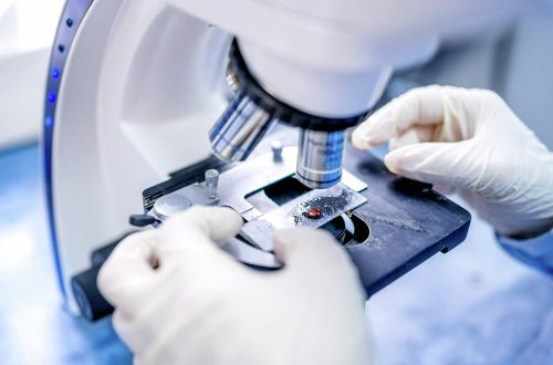 Avropada ölümcül virus baş qaldırdı