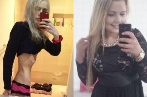 1 həftə yemək yemədi, bu hala düşdü