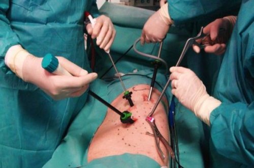 Gəncədə üç uşaq anası əməliyyatdan sonra öldü