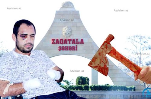 `Yalvardım ki, qolumu kəsməyin...`