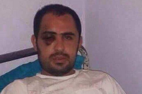 Borca görə əlləri kəsilən şəxsin